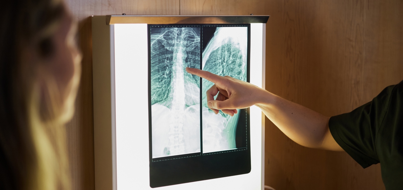 Bandscheibenvorfall LWS 4/5 Symptome Diagnose & Behandlung Physiotherapie Baumann in Poing